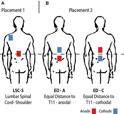 Changes in H-Reflex Recruitment After Trans-Spinal Direct Current Stimulation With Multiple Electrode Configurations